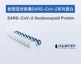 重组SARS-CoV-2核衣壳蛋白