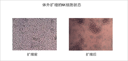 體外擴增的NK細胞狀態